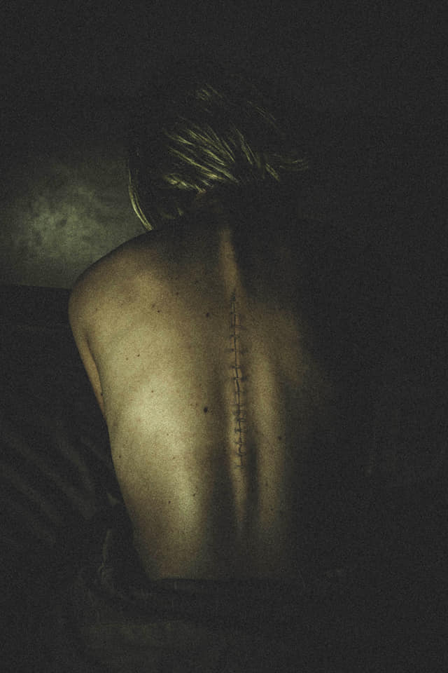 Liguilla Octubre – Cicatrices